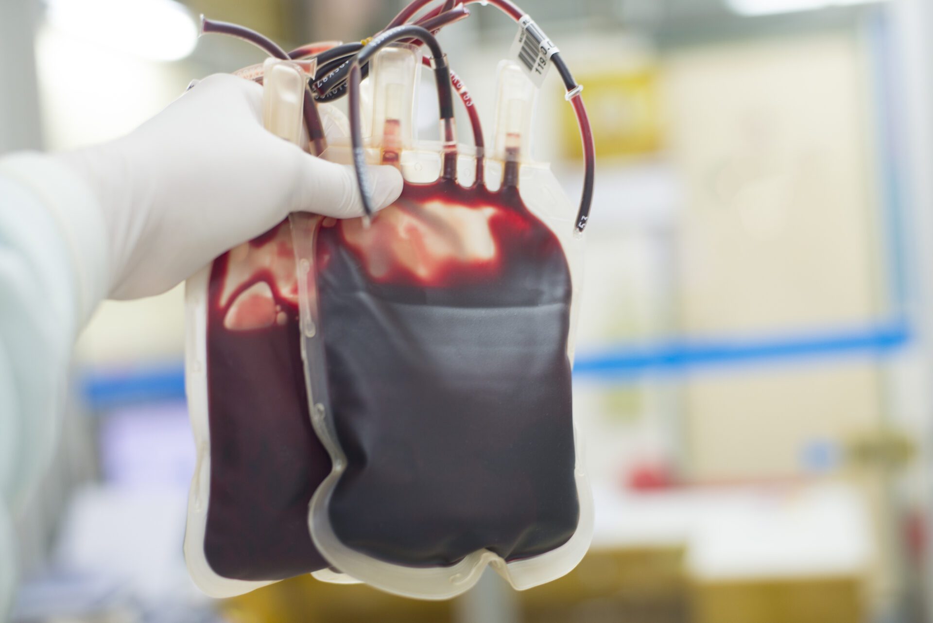 Les personnes de groupe sanguin Rh-0 ont un problème avec les transfusions sanguines.