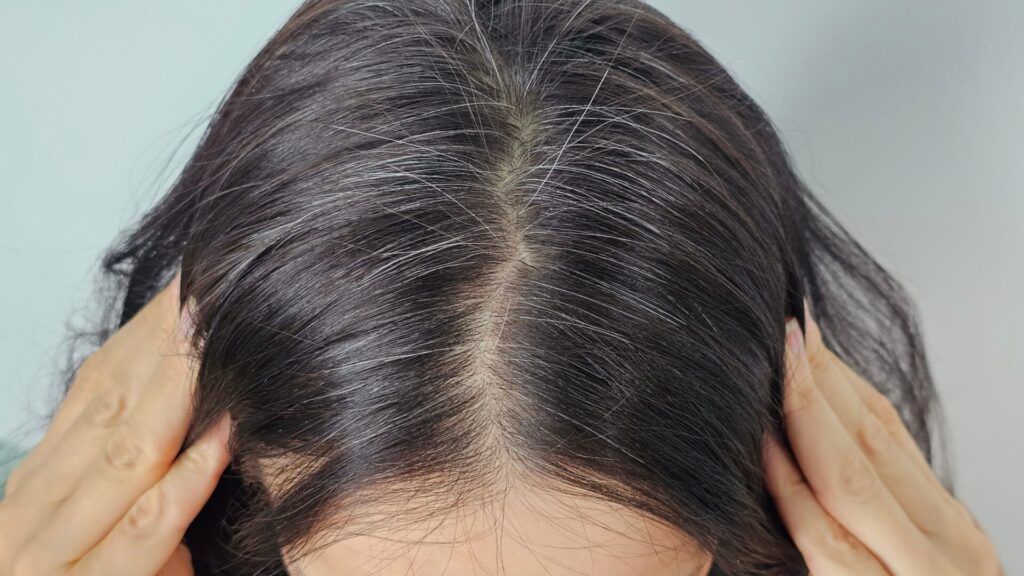 Les cheveux gris peuvent commencer à vous gêner dès votre plus jeune âge. Il est donc conseillé de suivre des mesures de prévention et de s'en prémunir.