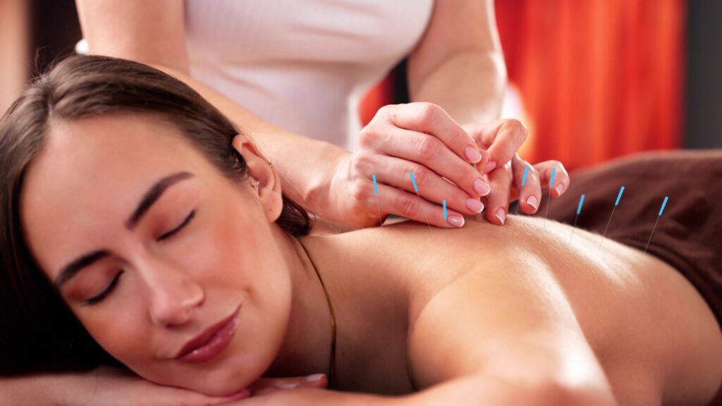 L'acupuncture trouve son origine dans la Chine ancienne.